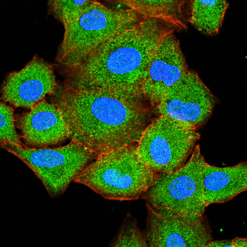TARDBP Antibody