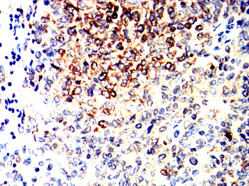 CDK5 Antibody