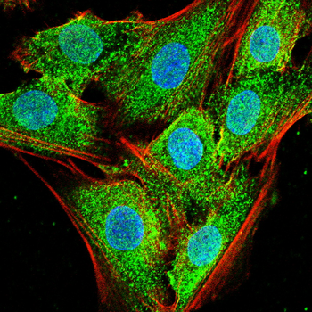 ARPC5 Antibody