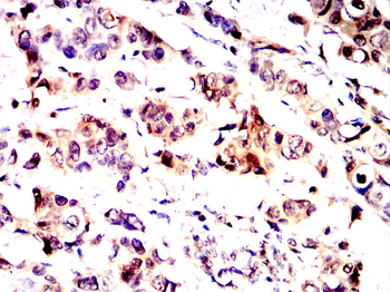 ARPC5 Antibody