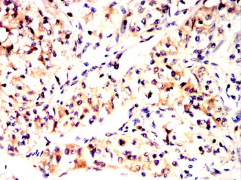ARPC5 Antibody