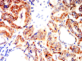 CDK2 Antibody