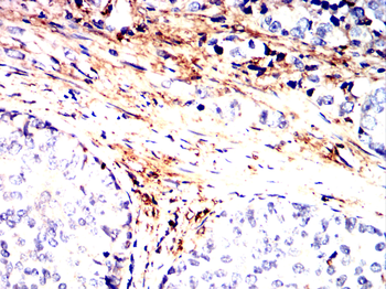 LGALS1 Antibody