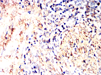 LGALS1 Antibody
