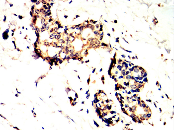 TIA1 Rabbit Polyclonal Antibody