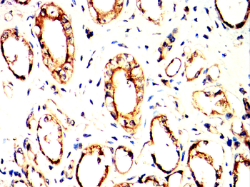 TIA1 Rabbit Polyclonal Antibody