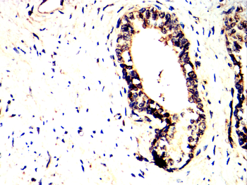 TIA1 Rabbit Polyclonal Antibody