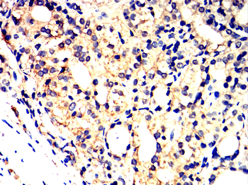 TIA1 Rabbit Polyclonal Antibody