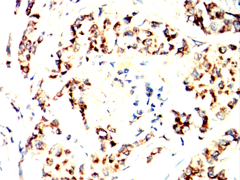 STAT3 Antibody