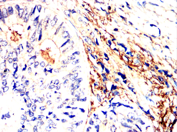 BCL2A1 Antibody