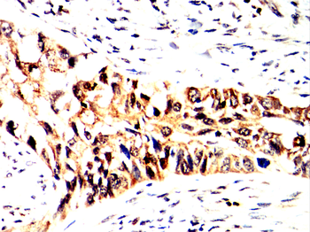 MMP3 Antibody