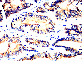 MMP3 Antibody