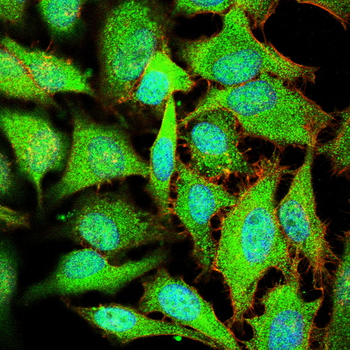PIM1 Rabbit Polyclonal Antibody