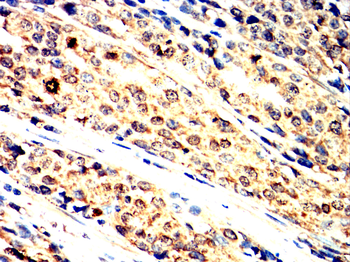 PIM1 Rabbit Polyclonal Antibody