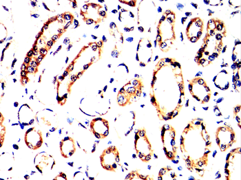 PIM1 Rabbit Polyclonal Antibody