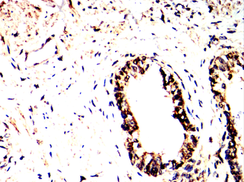 PIM1 Rabbit Polyclonal Antibody