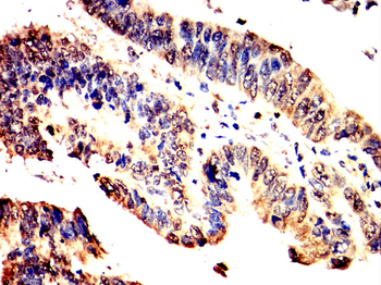 PIM1 Rabbit Polyclonal Antibody