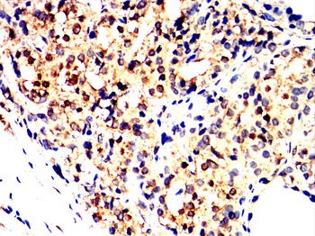 PIM1 Rabbit Polyclonal Antibody