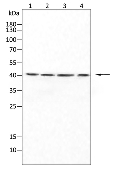 CXCR5 Rabbit Polyclonal Antibody