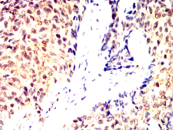 SATB2 Antibody