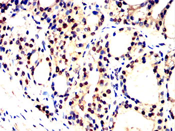 SATB2 Antibody