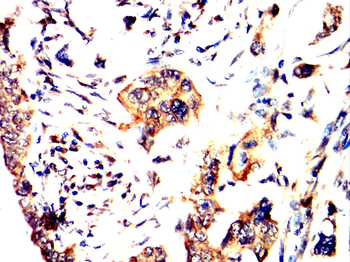 SMARCA4 Antibody