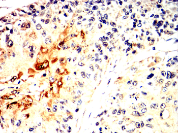SMARCA4 Antibody