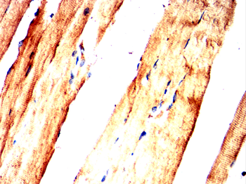 SMARCA4 Antibody