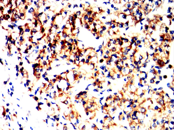 SMARCA4 Antibody