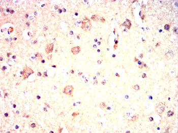 NGF Antibody