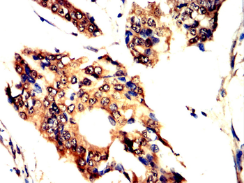 LAMP2 Antibody