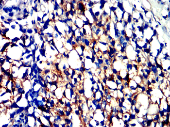 LAMP2 Antibody