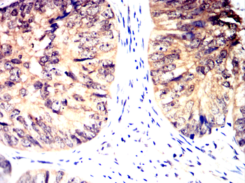 LAMP2 Antibody
