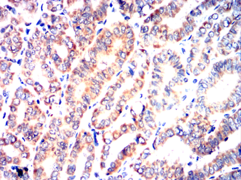 LAMP2 Antibody