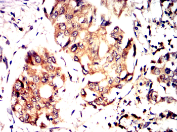ACACA Antibody