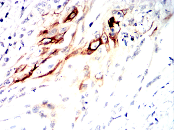 ACACA Antibody