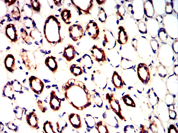 TH Antibody
