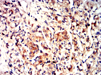 TH Antibody