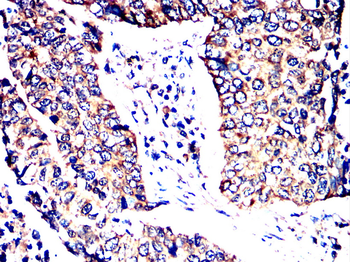 PDIA2 Antibody