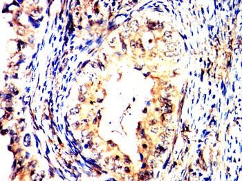 CDH1 Antibody