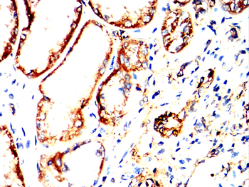 CDH1 Antibody