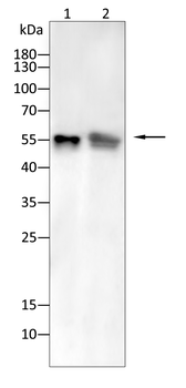 MMP1 Antibody