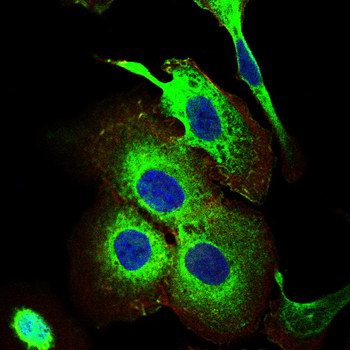 AP2M1 Antibody