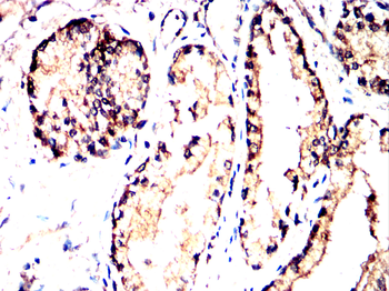 CNP Antibody
