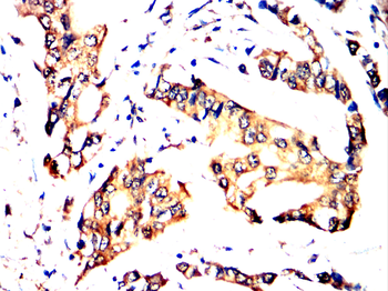 TTR Antibody