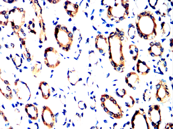 TTR Antibody
