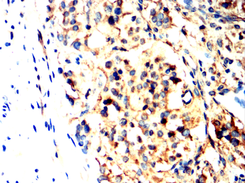 ACLY Antibody