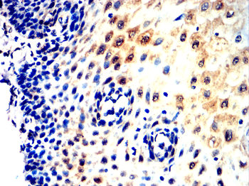 RPS3 Antibody