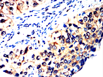 RPS3 Antibody