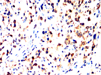 RPS3 Antibody